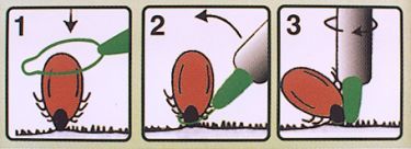 Veilig teken verwijderen lasso